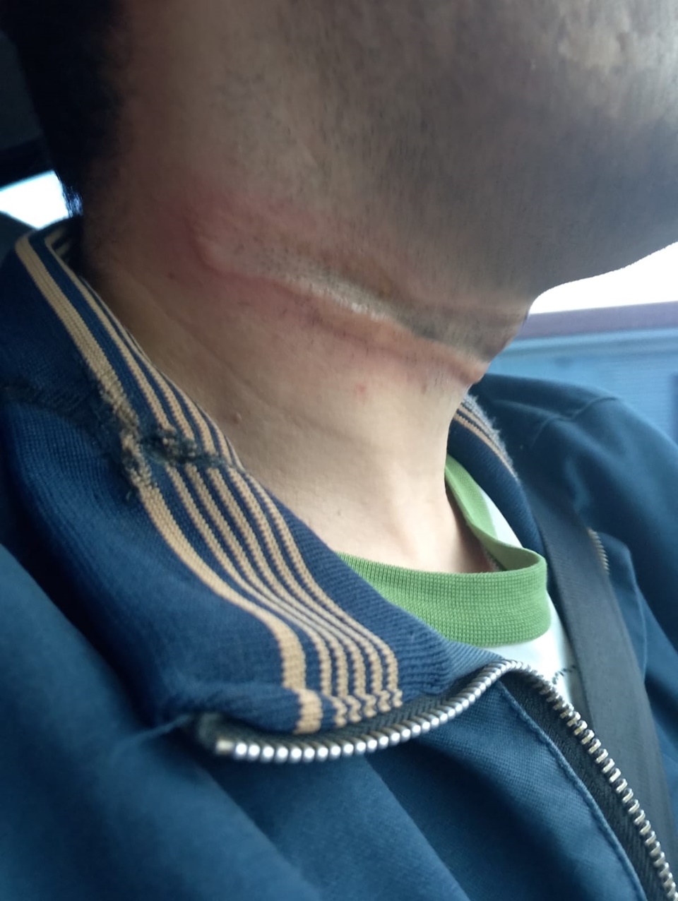 🚨Motociclista sofre ferimento no pescoço em fios pendurados em Campo Mourão