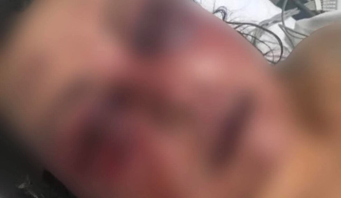 ARMADILHA NO WHATSAPP: Mulher se passa por marido da vítima e a atrai para emboscada com pauladas em Pitanga